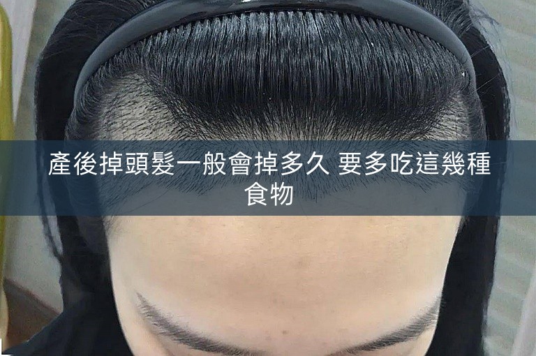 產後掉頭髮一般會掉多久 要多吃這幾種食物