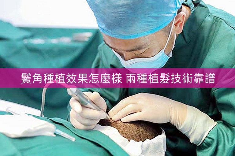 鬢角種植效果怎麼樣 兩種植髮技術靠譜