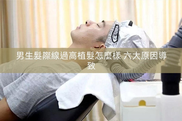 男生髮際線過高植髮怎麼樣 六大原因導致