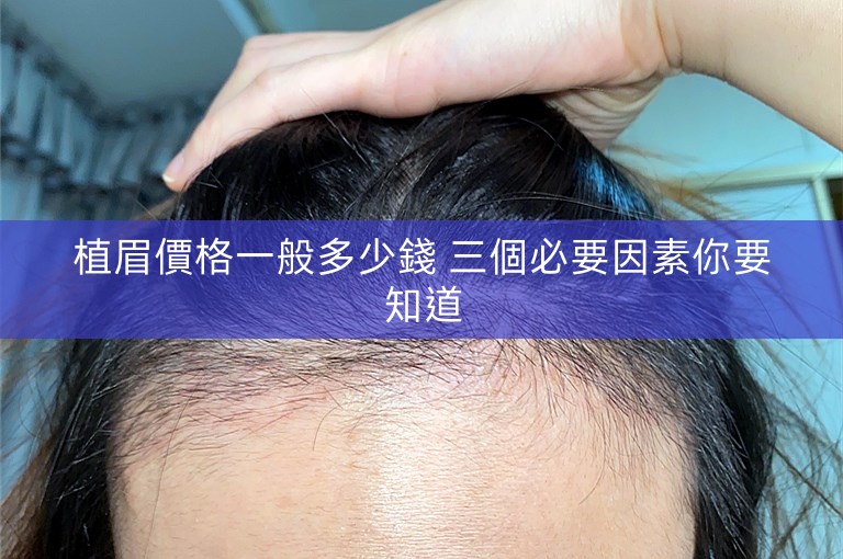 植眉價格一般多少錢 三個必要因素你要知道