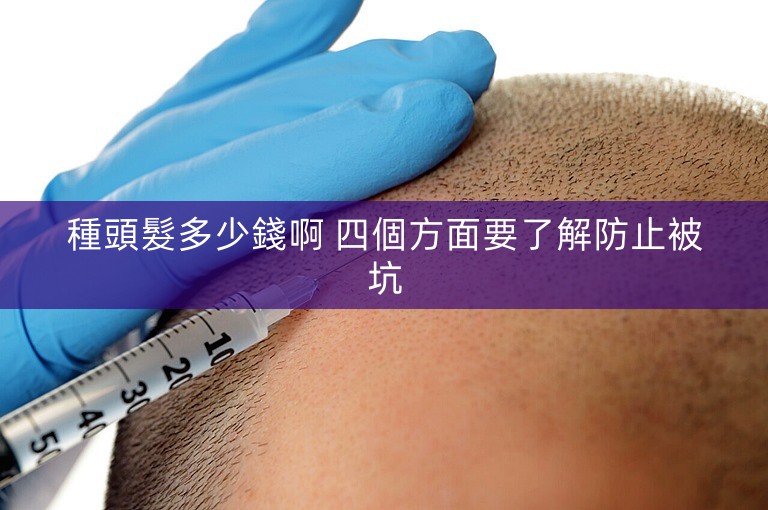 種頭髮多少錢啊 四個方面要了解防止被坑