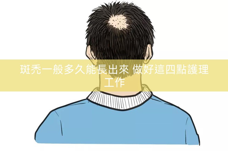 斑禿一般多久能長出來 做好這四點護理工作
