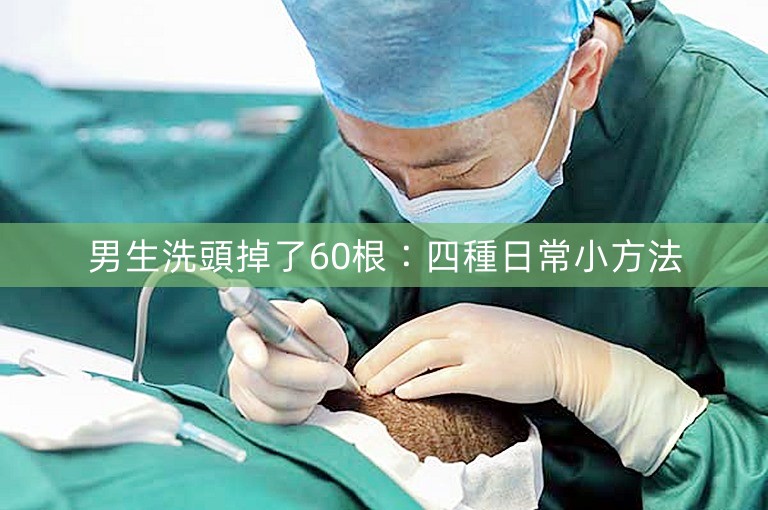 男生洗頭掉了60根：四種日常小方法