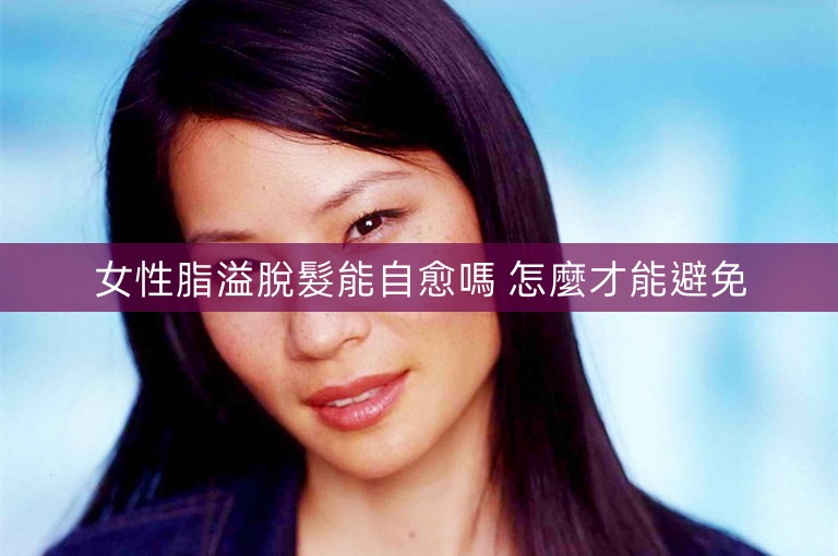 女性脂溢脫髮能自愈嗎 怎麼才能避免 女性脂溢脫髮能自愈嗎 怎麼才能避免