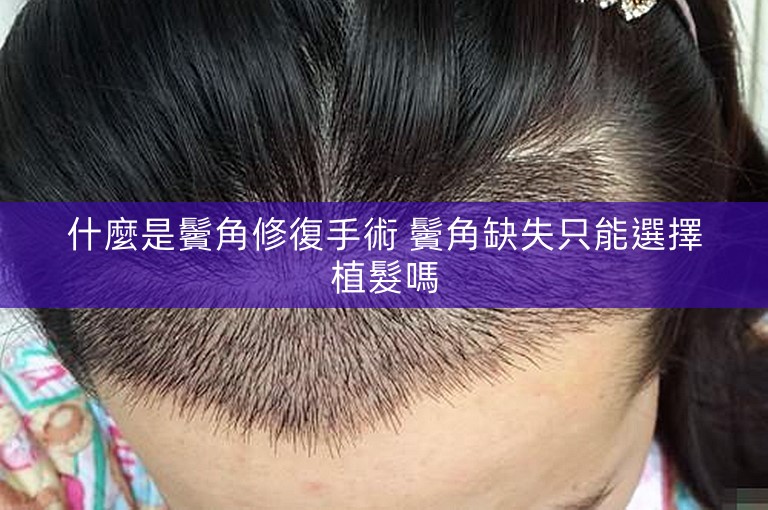 什麼是鬢角修復手術 鬢角缺失只能選擇植髮嗎