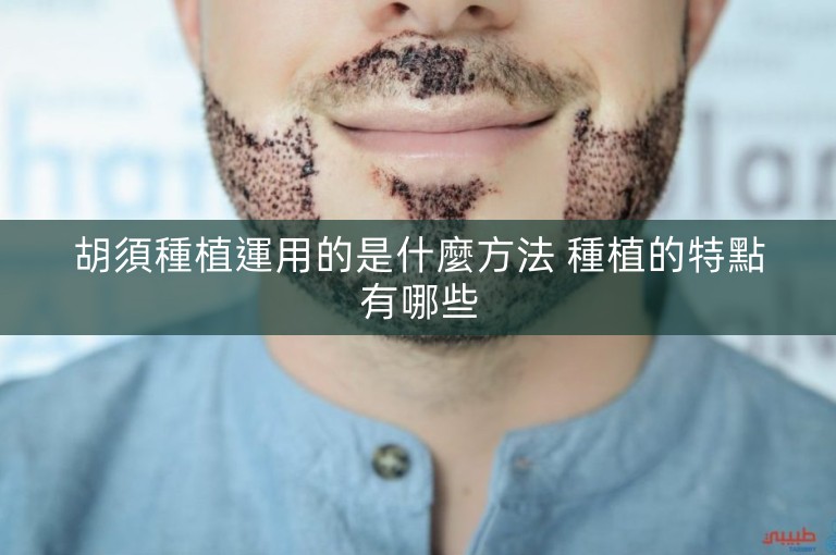胡須種植運用的是什麼方法 種植的特點有哪些 胡須種植運用的是什麼方法 種植的特點有哪些