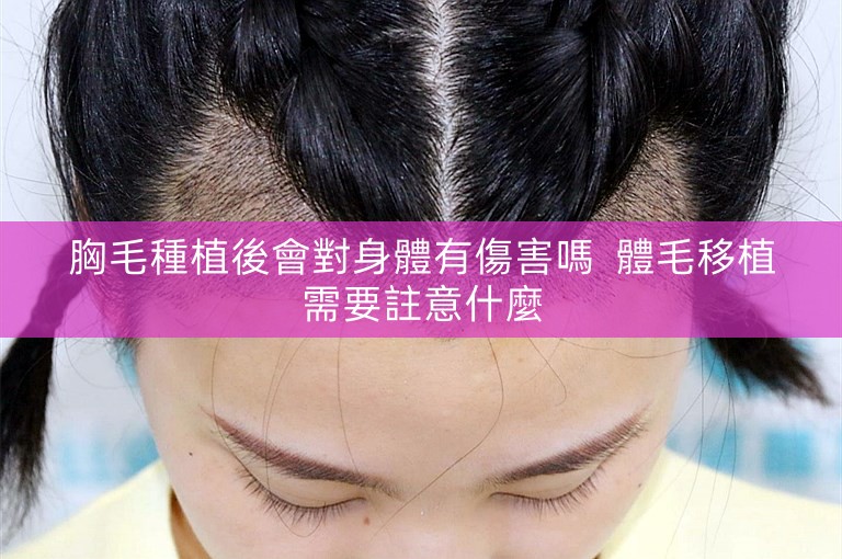 胸毛種植後會對身體有傷害嗎  體毛移植需要註意什麼