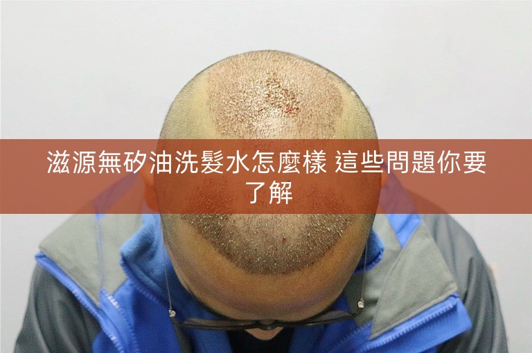 滋源無矽油洗髮水怎麼樣 這些問題你要了解