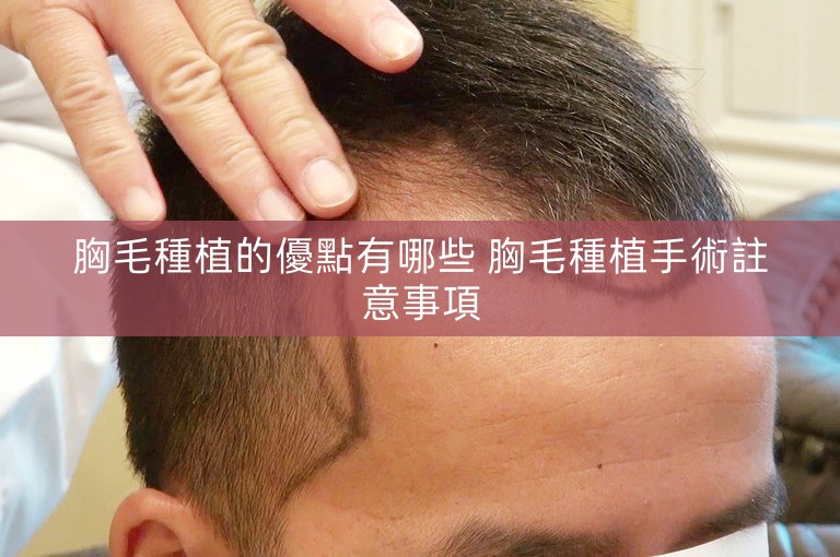 胸毛種植的優點有哪些 胸毛種植手術註意事項