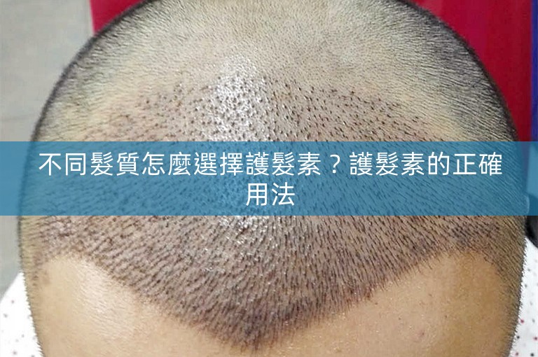 不同髮質怎麼選擇護髮素？護髮素的正確用法