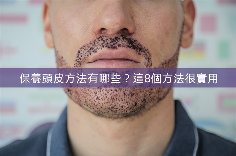 保養頭皮方法有哪些？這8個方法很實用