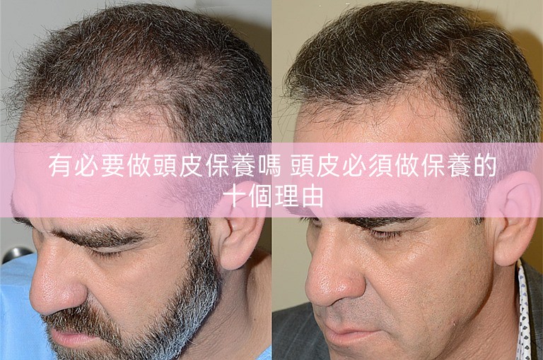 有必要做頭皮保養嗎 頭皮必須做保養的十個理由 有必要做頭皮保養嗎 頭皮必須做保養的十個理由