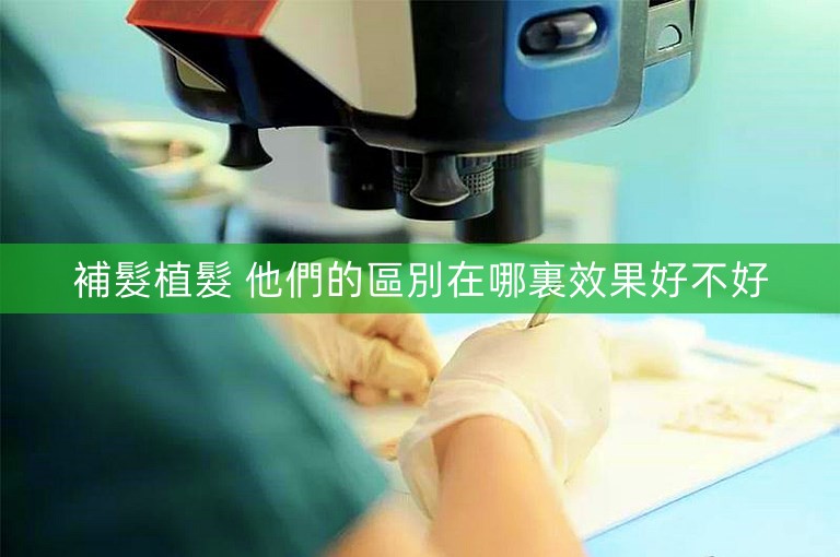 補髮植髮 他們的區別在哪裏效果好不好