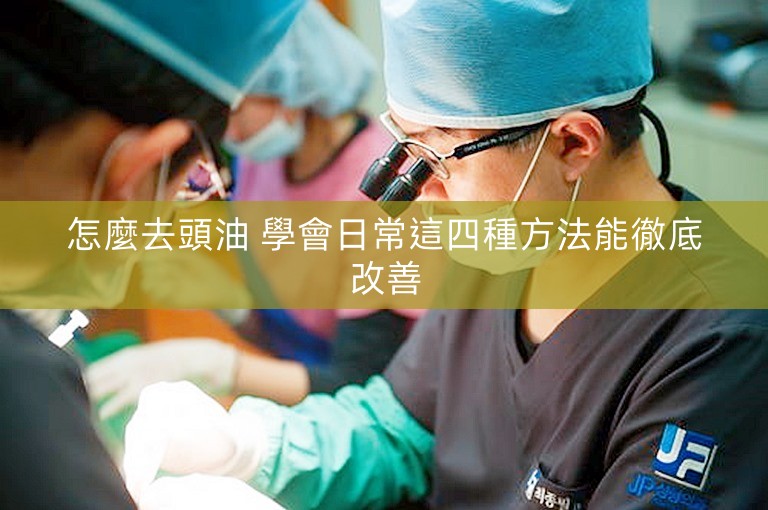 怎麼去頭油 學會日常這四種方法能徹底改善