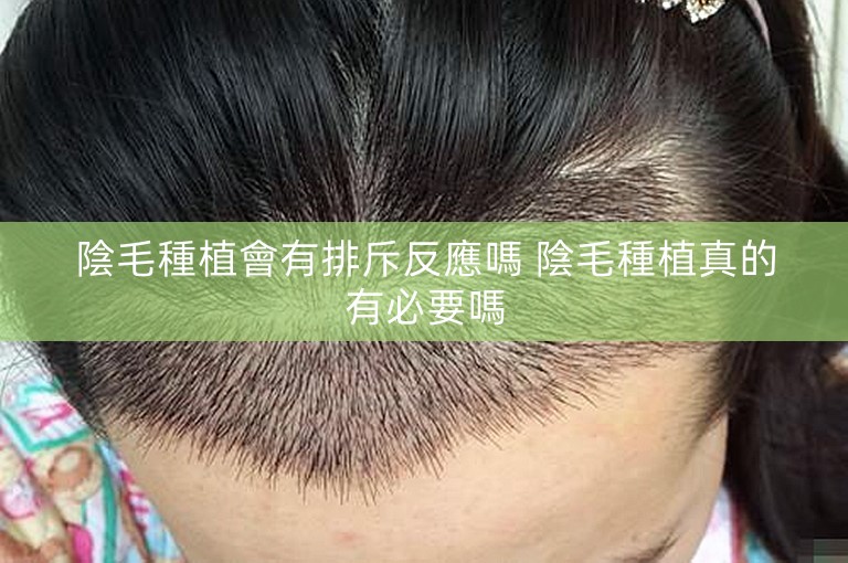 陰毛種植會有排斥反應嗎 陰毛種植真的有必要嗎 陰毛種植會有排斥反應嗎 陰毛種植真的有必要嗎