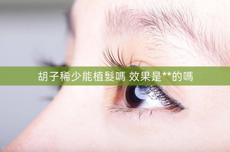 胡子稀少能植髮嗎 效果是**的嗎