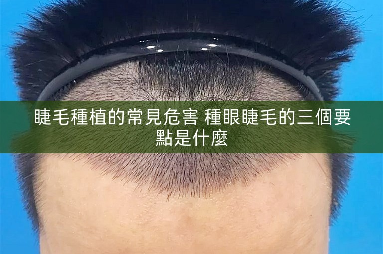 睫毛種植的常見危害 種眼睫毛的三個要點是什麼