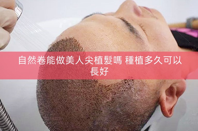 自然卷能做美人尖植髮嗎 種植多久可以長好