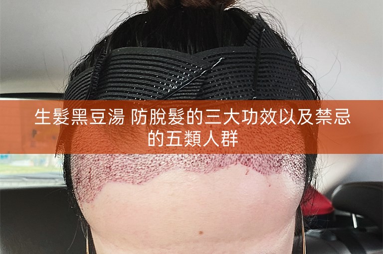 生髮黑豆湯 防脫髮的三大功效以及禁忌的五類人群