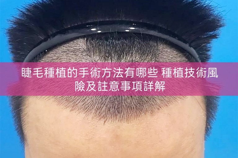 睫毛種植的手術方法有哪些 種植技術風險及註意事項詳解