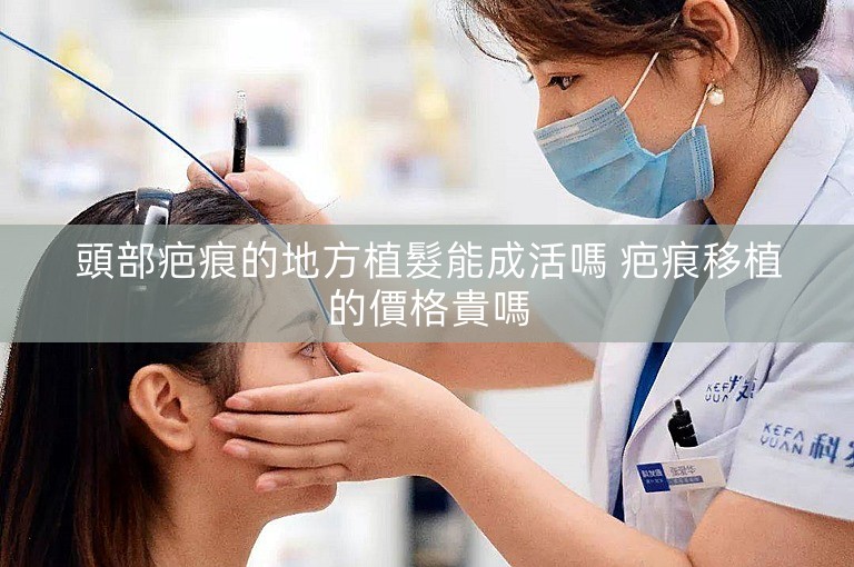頭部疤痕的地方植髮能成活嗎 疤痕移植的價格貴嗎