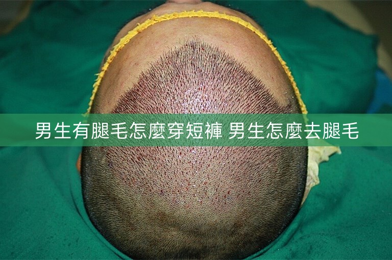 男生有腿毛怎麼穿短褲 男生怎麼去腿毛 男生有腿毛怎麼穿短褲 男生怎麼去腿毛