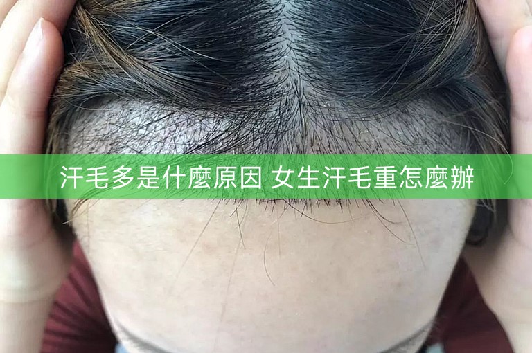 汗毛多是什麼原因 女生汗毛重怎麼辦 汗毛多是什麼原因 女生汗毛重怎麼辦