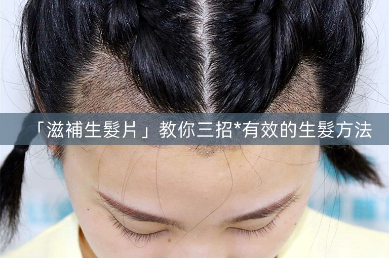 「滋補生髮片」教你三招*有效的生髮方法 「滋補生髮片」教你三招*有效的生髮方法