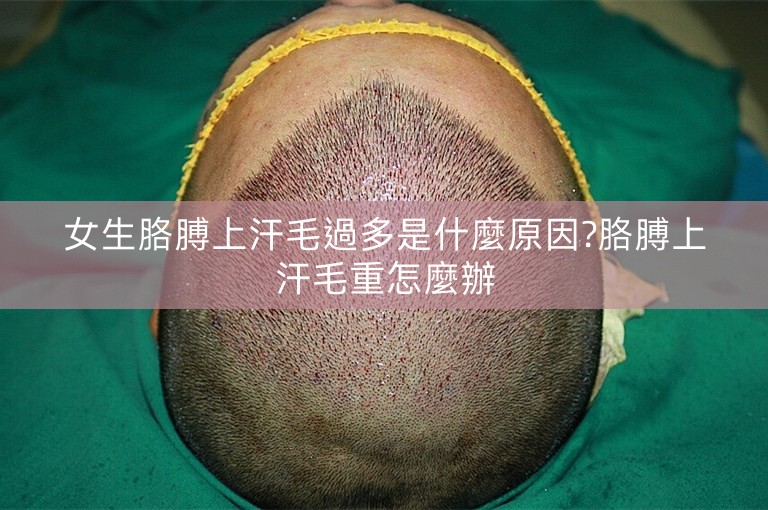 女生胳膊上汗毛過多是什麼原因?胳膊上汗毛重怎麼辦 女生胳膊上汗毛過多是什麼原因?胳膊上汗毛重怎麼辦