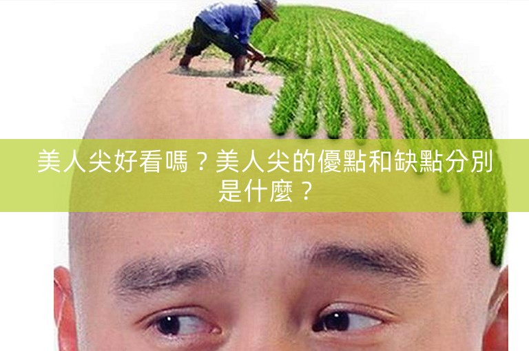 美人尖好看嗎?美人尖的優點和缺點分別是什麼? 美人尖好看嗎?美人尖的優點和缺點分別是什麼?