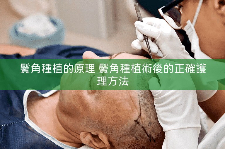 鬢角種植的原理 鬢角種植術後的正確護理方法