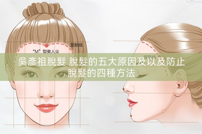 吳彥祖脫髮 脫髮的五大原因及以及防止脫髮的四種方法