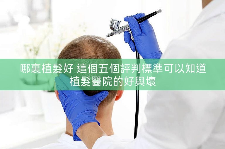 哪裏植髮好 這個五個評判標準可以知道植髮醫院的好與壞