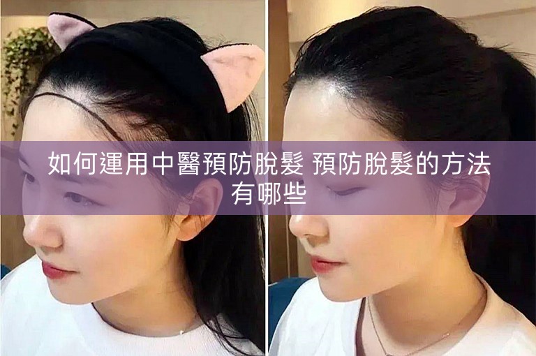 如何運用中醫預防脫髮 預防脫髮的方法有哪些