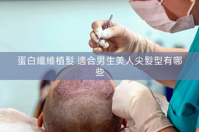 蛋白纖維植髮 適合男生美人尖髮型有哪些