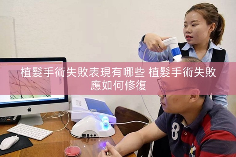 植髮手術失敗表現有哪些 植髮手術失敗應如何修復