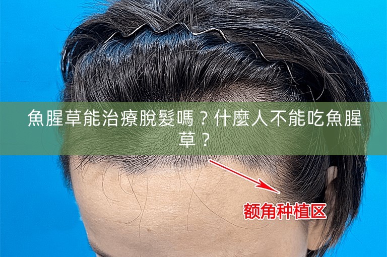 魚腥草能治療脫髮嗎？什麼人不能吃魚腥草？