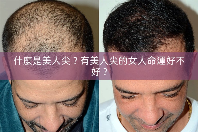 什麼是美人尖?有美人尖的女人命運好不好? 什麼是美人尖?有美人尖的女人命運好不好?