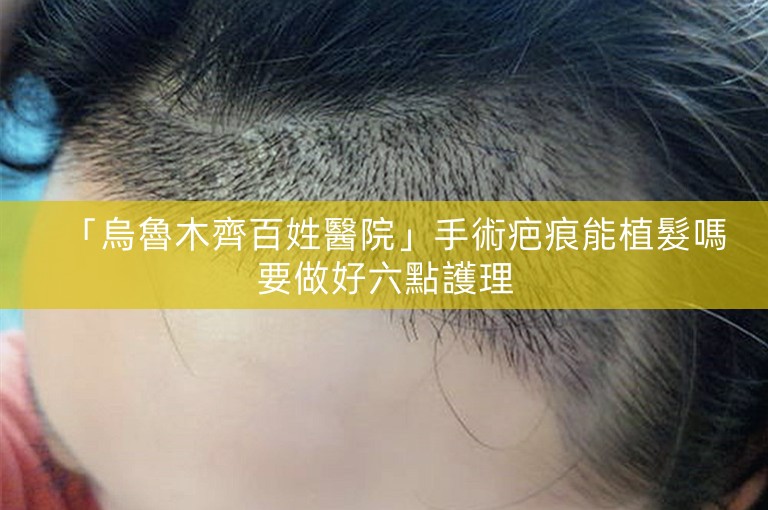 「烏魯木齊百姓醫院」手術疤痕能植髮嗎要做好六點護理