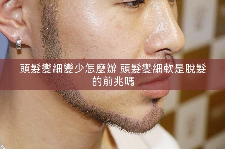 頭髮變細變少怎麼辦 頭髮變細軟是脫髮的前兆嗎 頭髮變細變少怎麼辦 頭髮變細軟是脫髮的前兆嗎