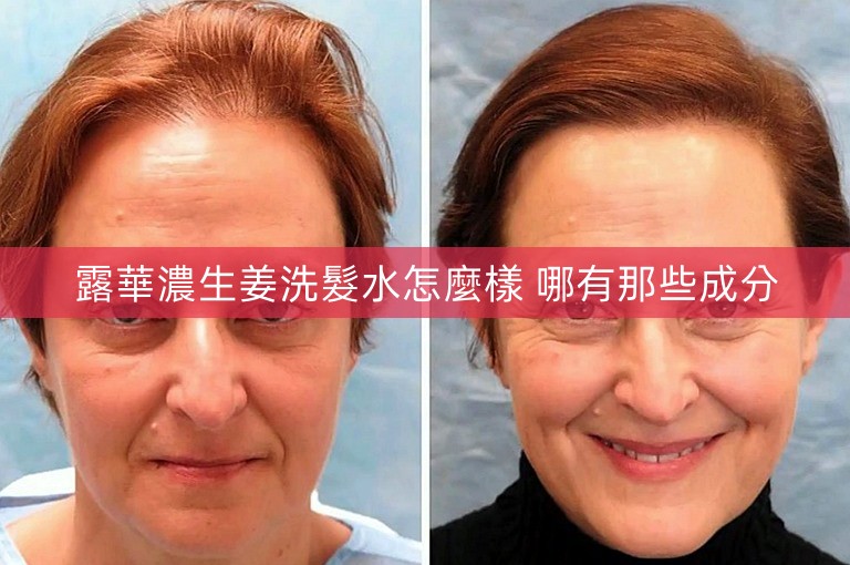 露華濃生姜洗髮水怎麼樣 哪有那些成分