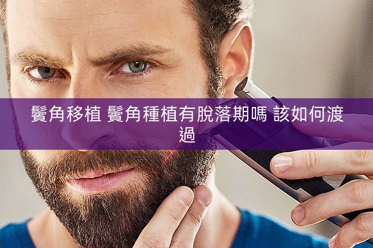 鬢角移植 鬢角種植有脫落期嗎 該如何渡過