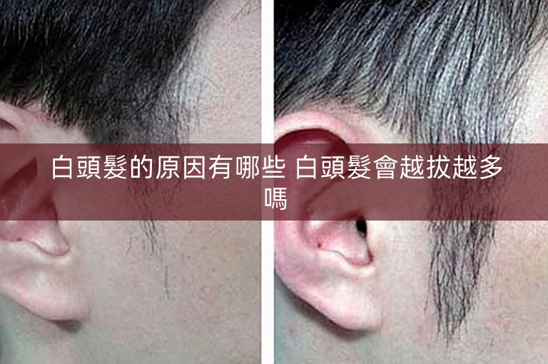 白頭髮的原因有哪些 白頭髮會越拔越多嗎