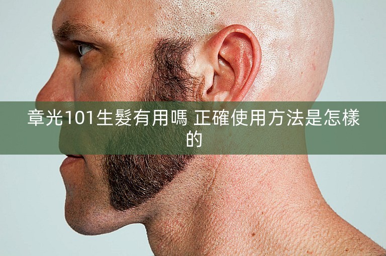 章光101生髮有用嗎 正確使用方法是怎樣的