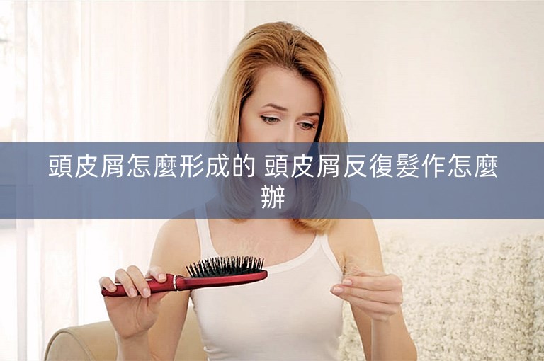頭皮屑怎麼形成的 頭皮屑反復髮作怎麼辦
