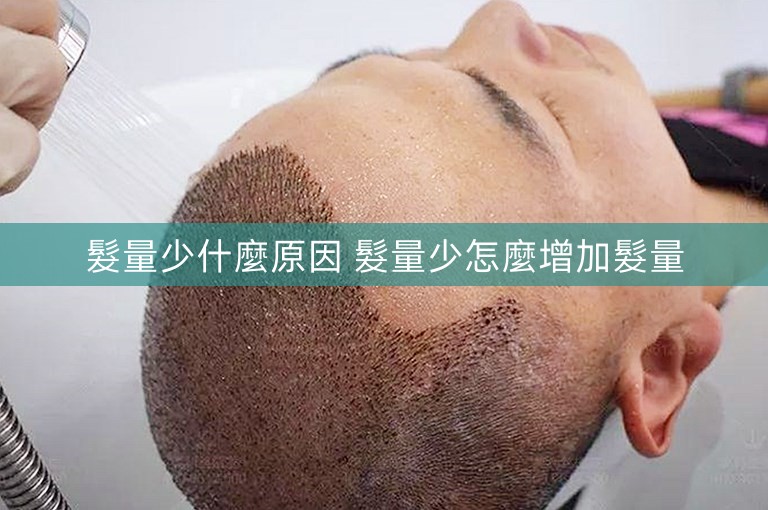 髮量少什麼原因 髮量少怎麼增加髮量