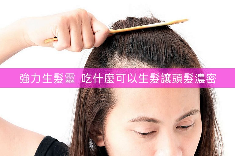 強力生髮靈 吃什麼可以生髮讓頭髮濃密 強力生髮靈 吃什麼可以生髮讓頭髮濃密
