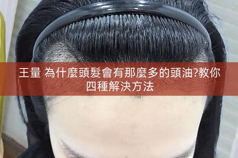 王量 為什麼頭髮會有那麼多的頭油?教你四種解決方法
