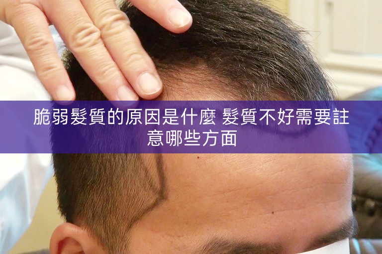 脆弱髮質的原因是什麼 髮質不好需要註意哪些方面