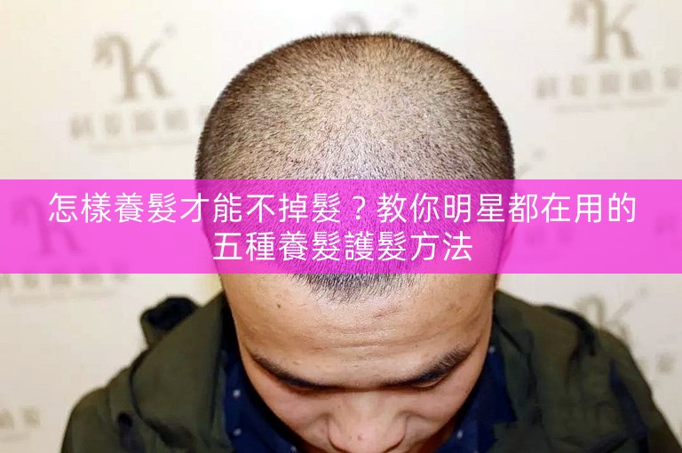 怎樣養髮才能不掉髮？教你明星都在用的五種養髮護髮方法